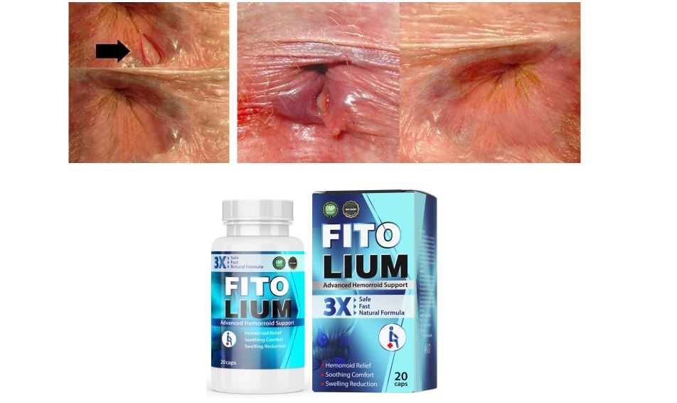 Fitolium Capsules – Uses, Side Effects, Benefits, Price in India!